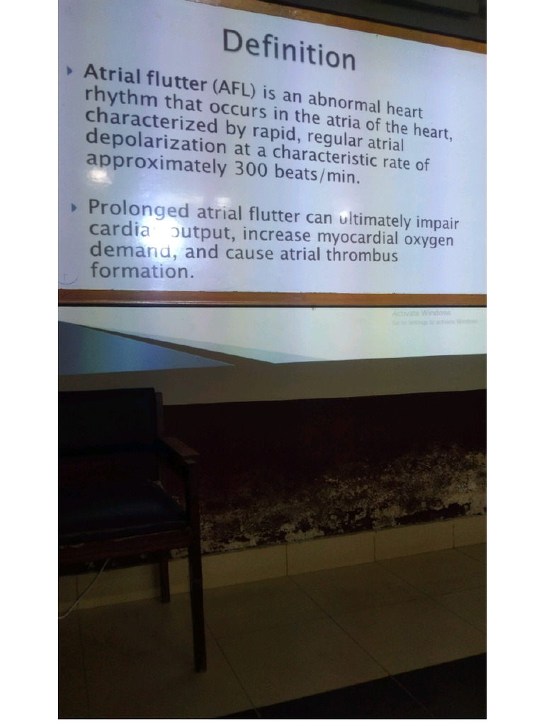 Atrial Flutter | PDF
