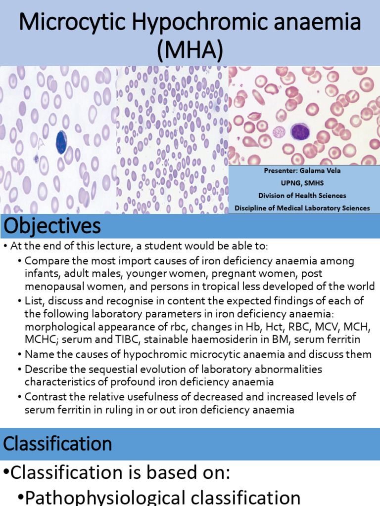 Understanding Microcytic Hypochromic Anaemia | PDF | Anemia | Hematology