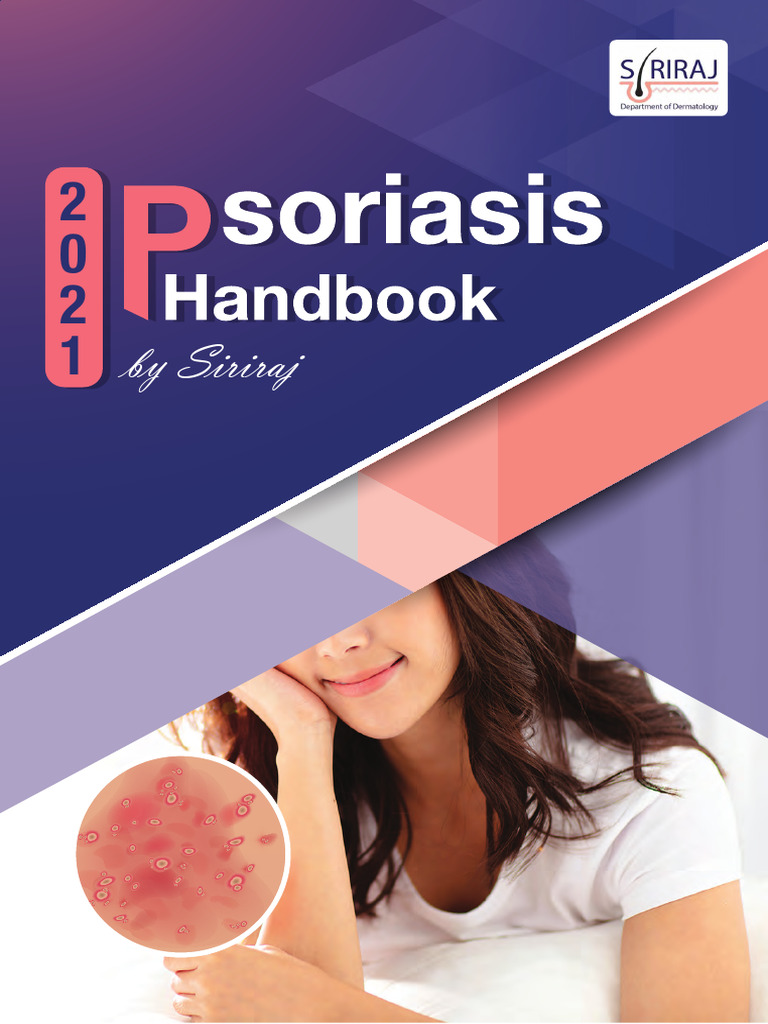 2021 Psoriasis Handbook by Siriraj Dermatology | PDF