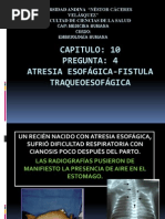 ATRESIA ESOFÁGICA-fistula Traqueoesofágica