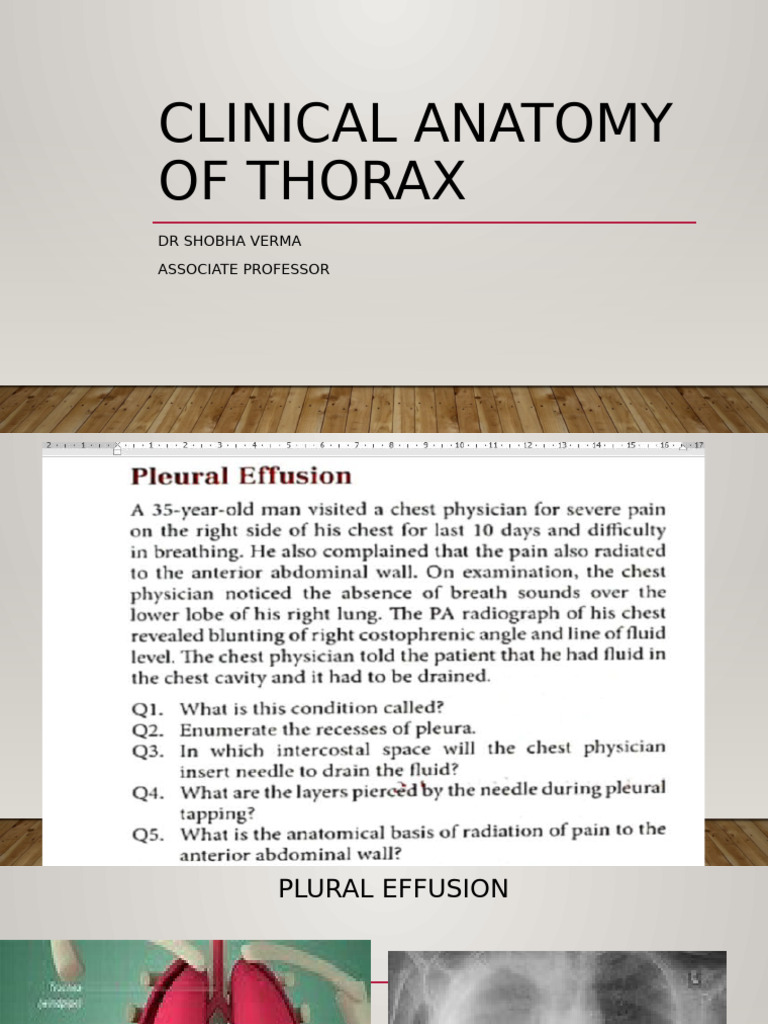 Clinical Anatomy of Thorax | PDF