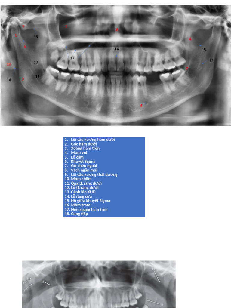 Cdha | PDF