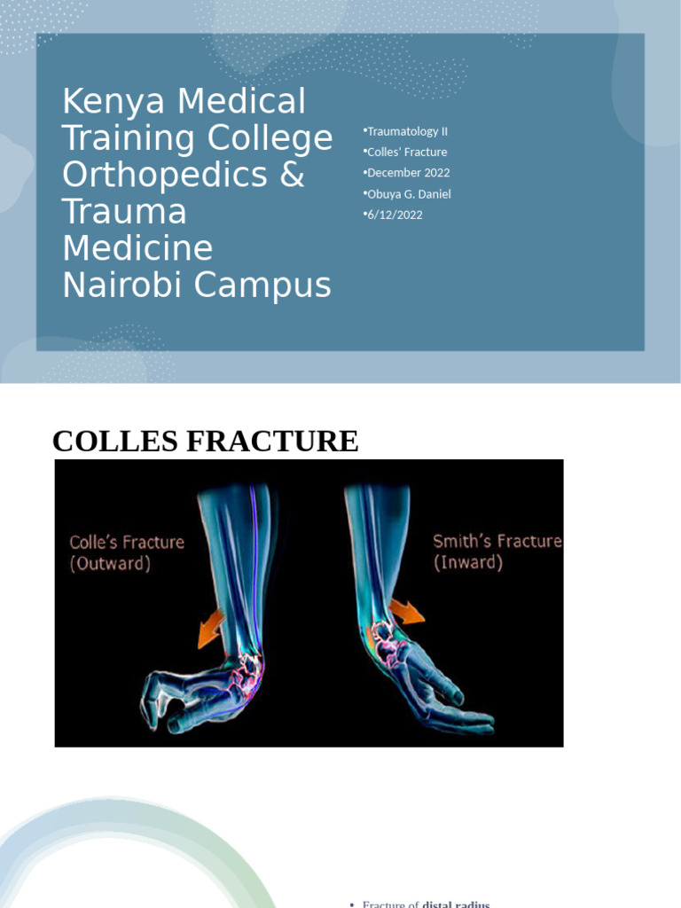 Understanding Colles Fracture Management | PDF