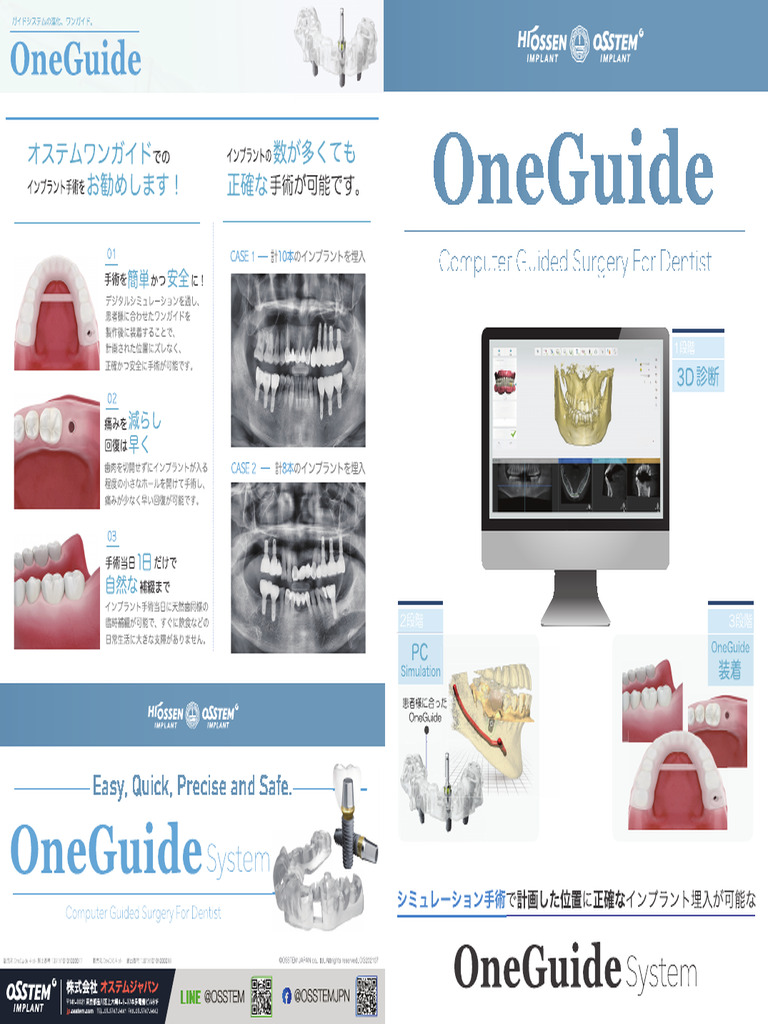 Oneguide Kit | PDF