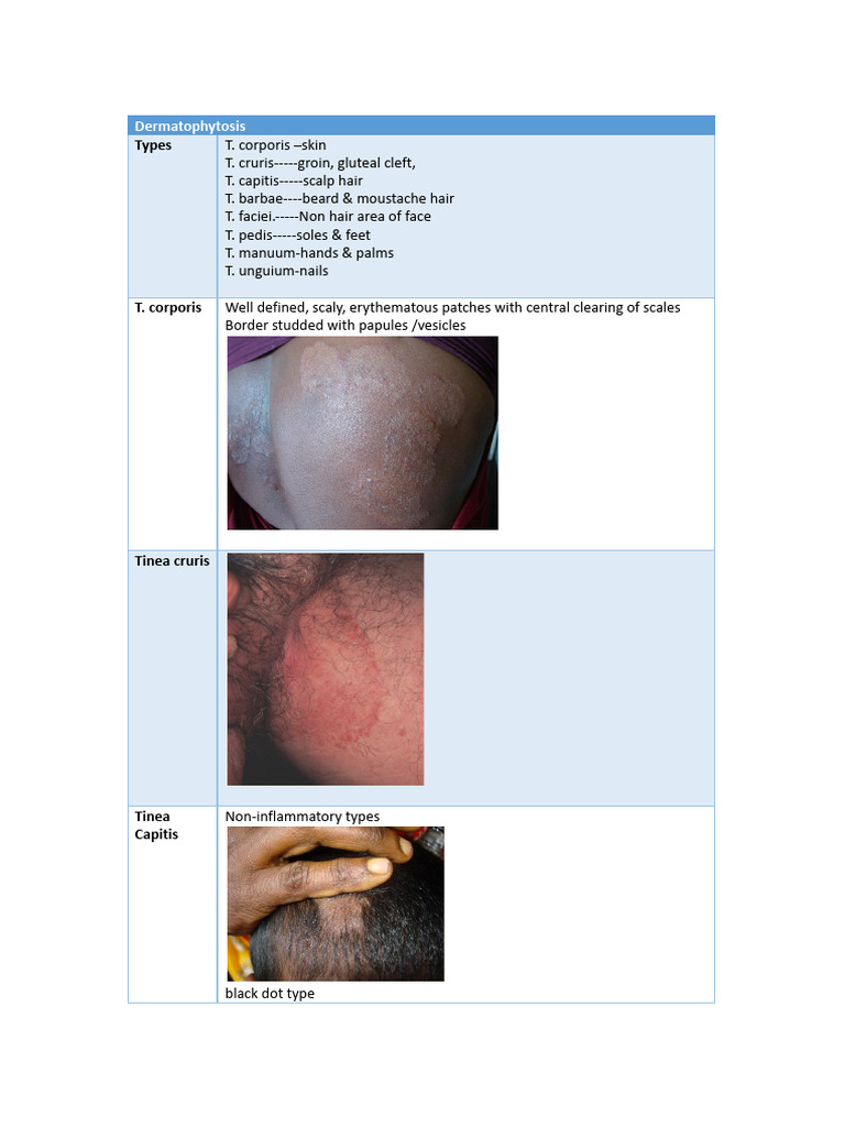 Types and Treatment of Dermatophytosis | PDF | Mycology | Skin