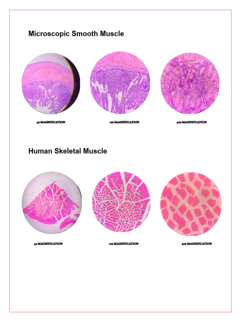 Microscopic Muscle Types and Disorders | PDF