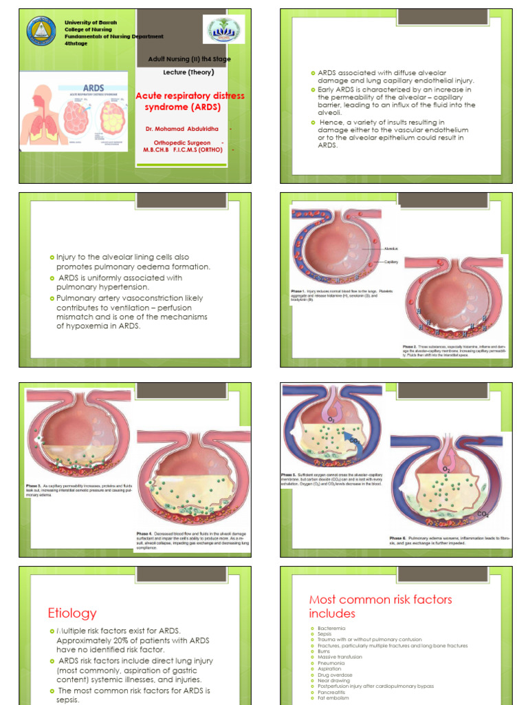 Understanding Acute Respiratory Distress Syndrome | PDF | Respiration ...