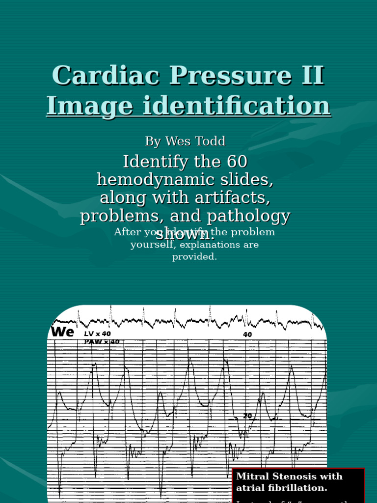 Pressure Tracings by Wes Todd 2 | PDF | Diastole | Blood Pressure