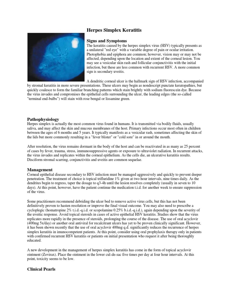Herpes Simplex Keratitis | PDF | Herpes Simplex | Immunology