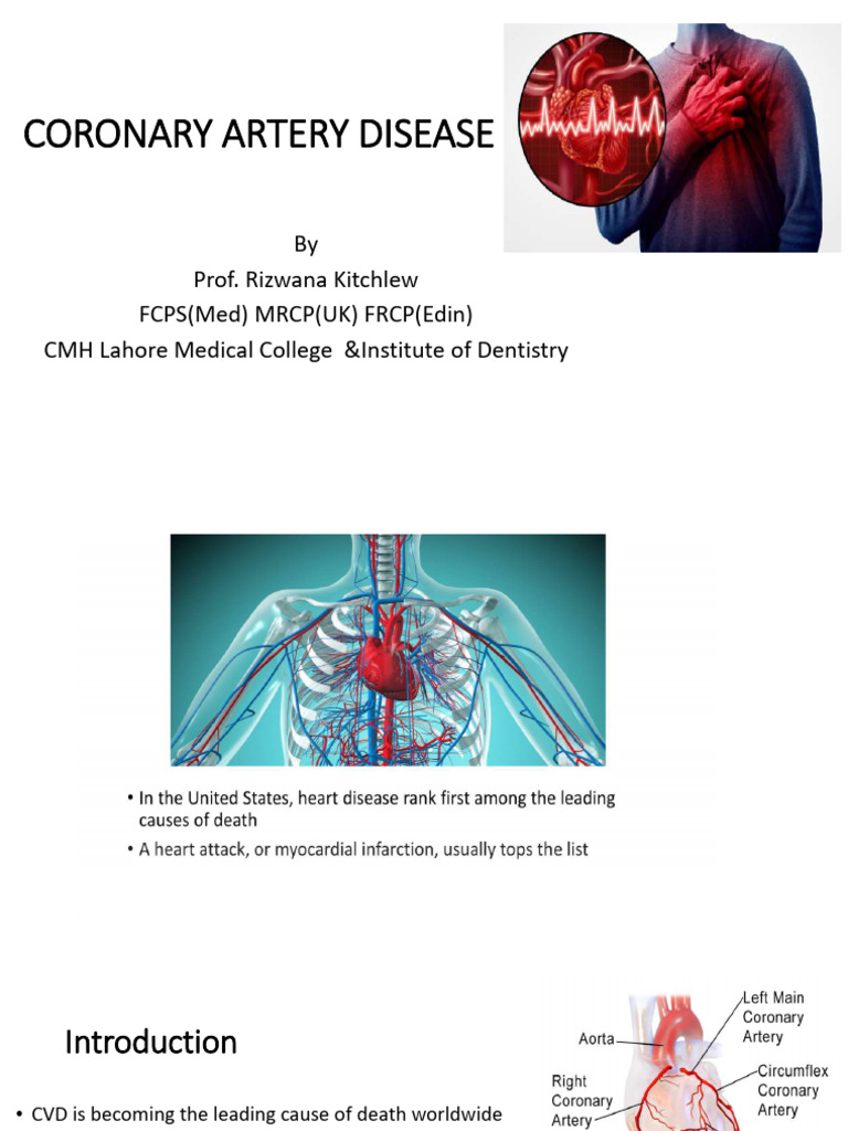 Understanding Coronary Artery Disease | PDF | Myocardial Infarction ...
