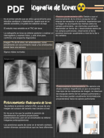 Radiografía Normal de Tórax: Anatomía y Criterios | PDF | Tórax | Pulmón