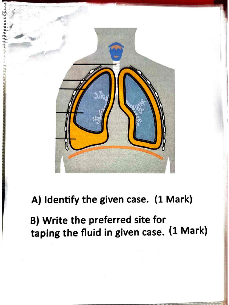 Clinical Case | PDF