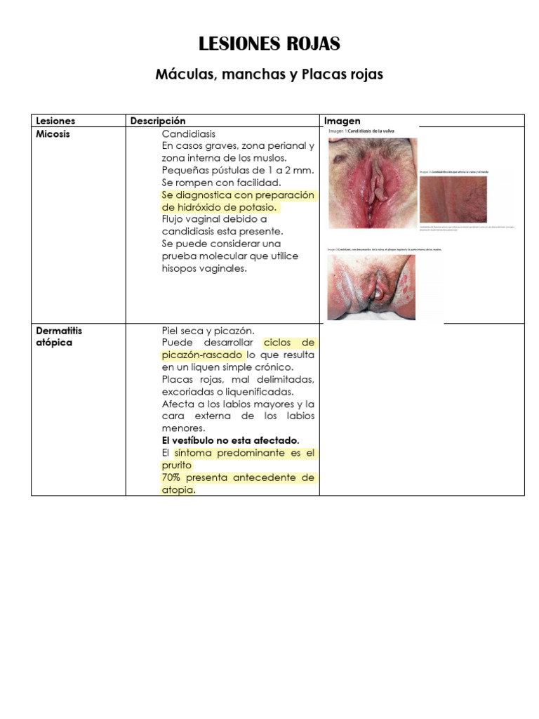 Lesiones Rojas: Tipos y Diagnóstico | PDF | Psoriasis | Labios