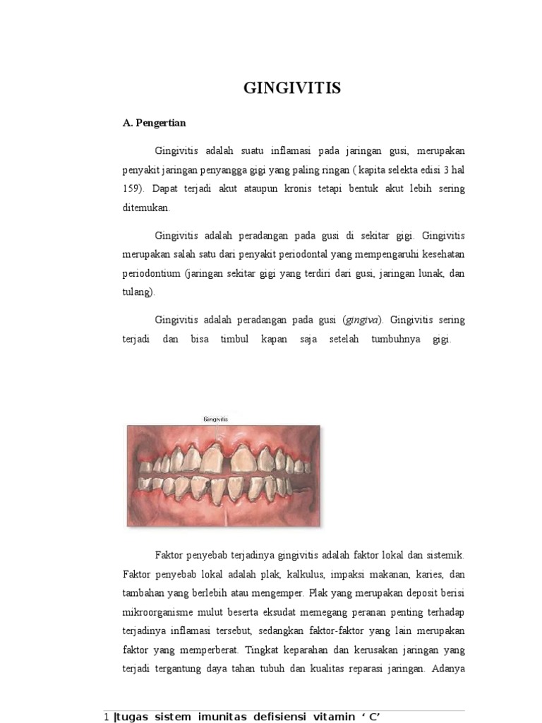 Jenis dan Gejala Gingivitis | PDF