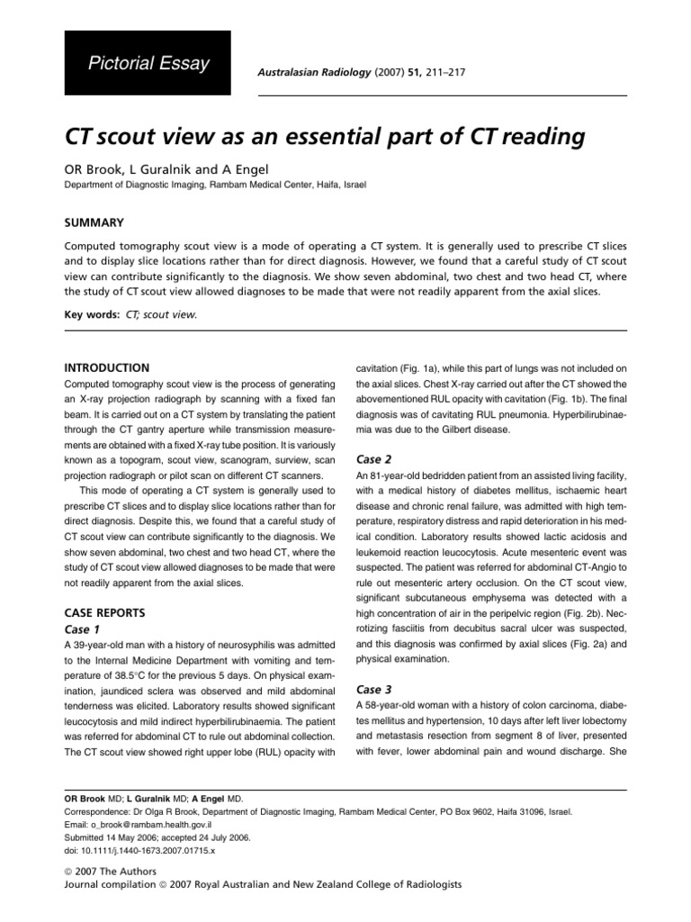 Importance of CT Scout View in Diagnosis | PDF | Ct Scan | Radiology
