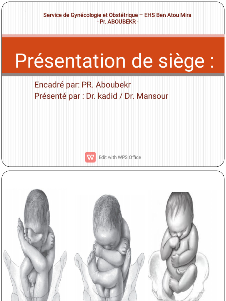 Accouchement par présentation du siège | PDF | Accouchement | Utérus