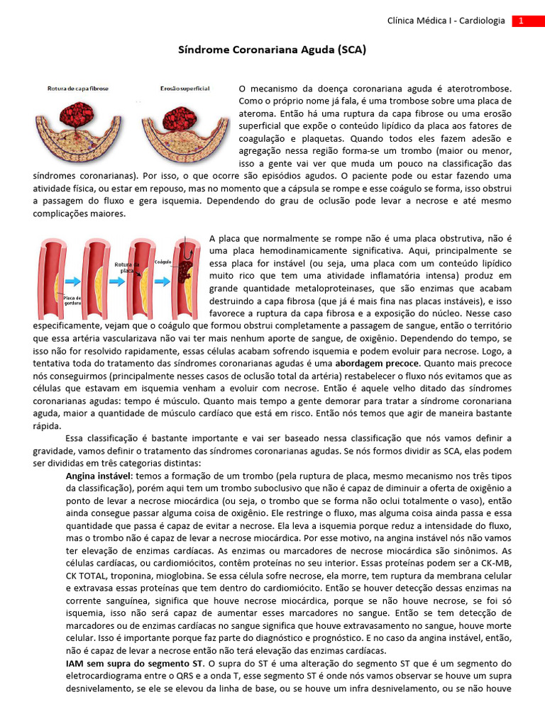 Síndrome Coronariana Aguda: Diagnóstico e Tratamento | PDF | Infarto do ...