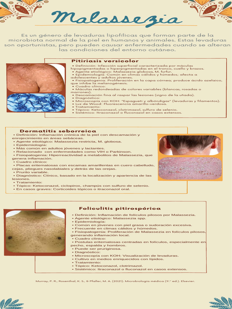 Enfermedades Por Malassezia Diagn stico Y Tratamiento PDF Piel 