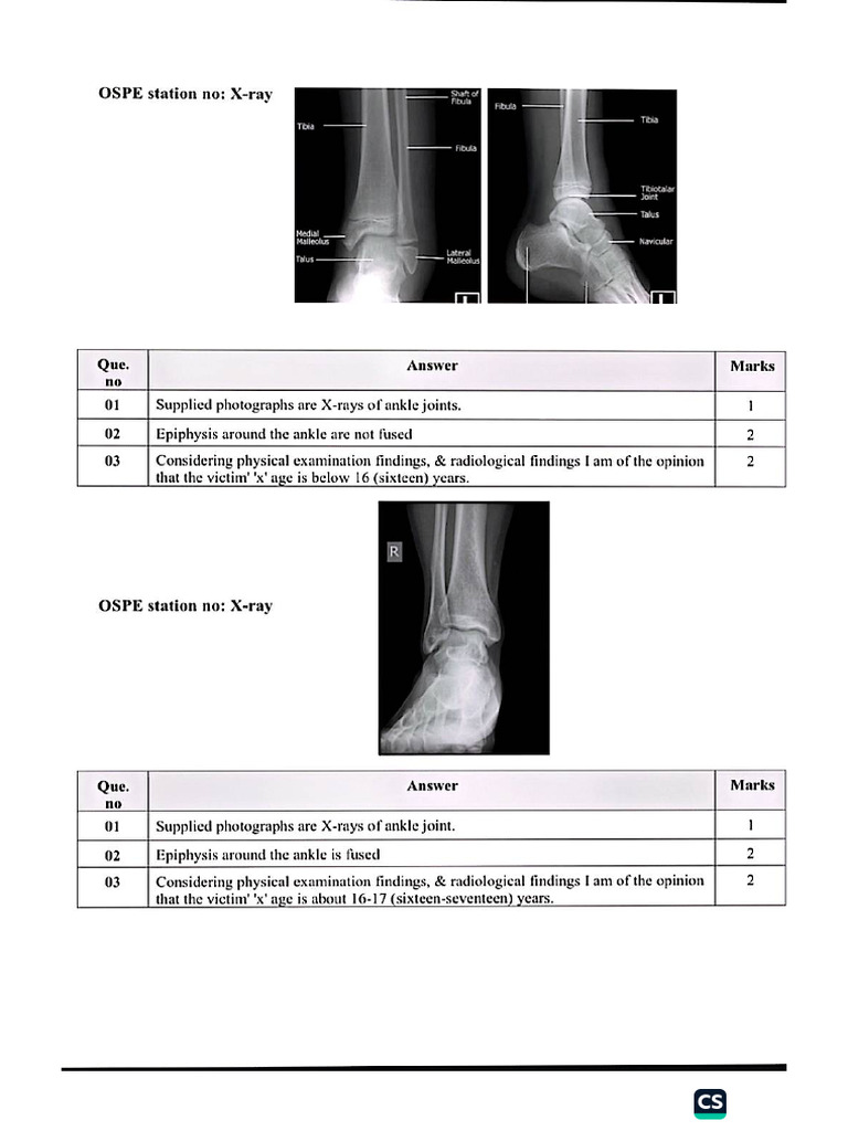 X Ray | PDF