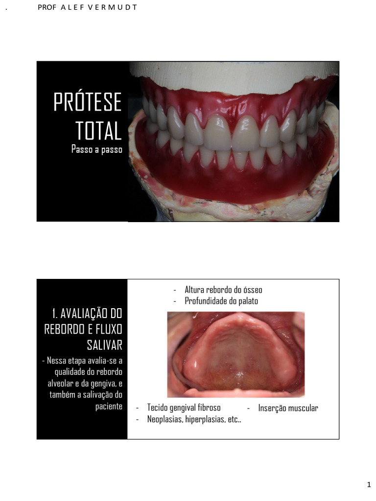 Passo a Passo da Prótese Total | PDF | Dente humano | Boca