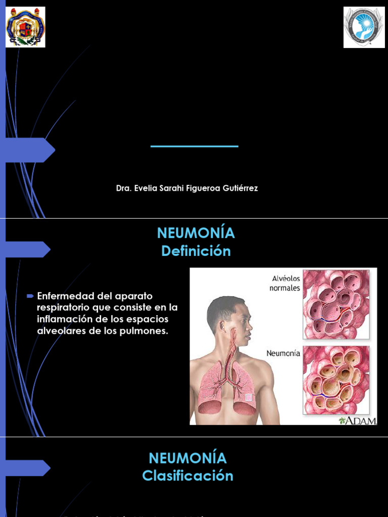 Neumonía-Clase | PDF | Neumonía | Neumología