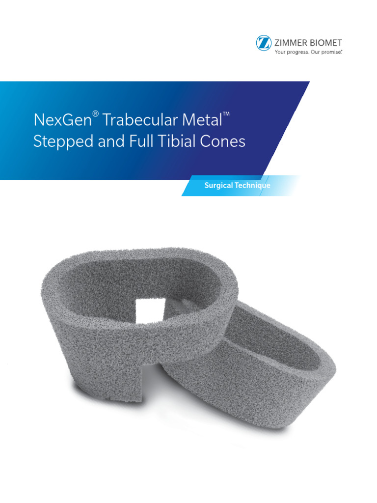 Nex Gen Trabecular Metal Steppedand Full Tibial Cones Surg Tech ...