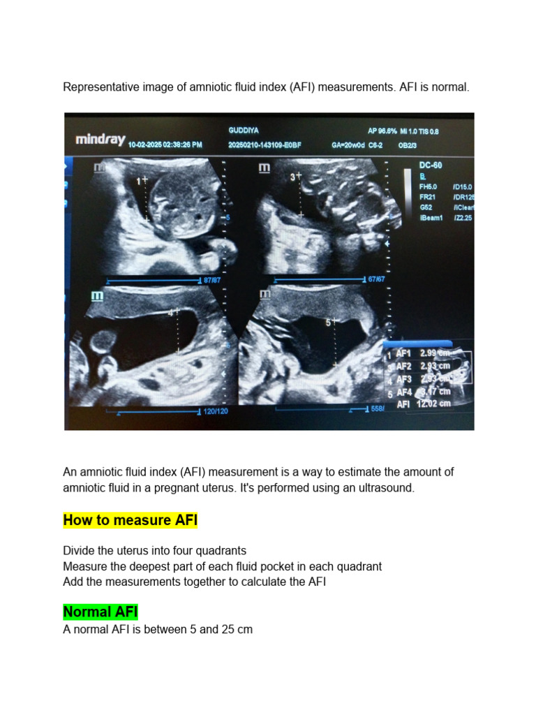 Amniotic Fluid Index (AFI) Measurement Guide | PDF | Diseases And ...