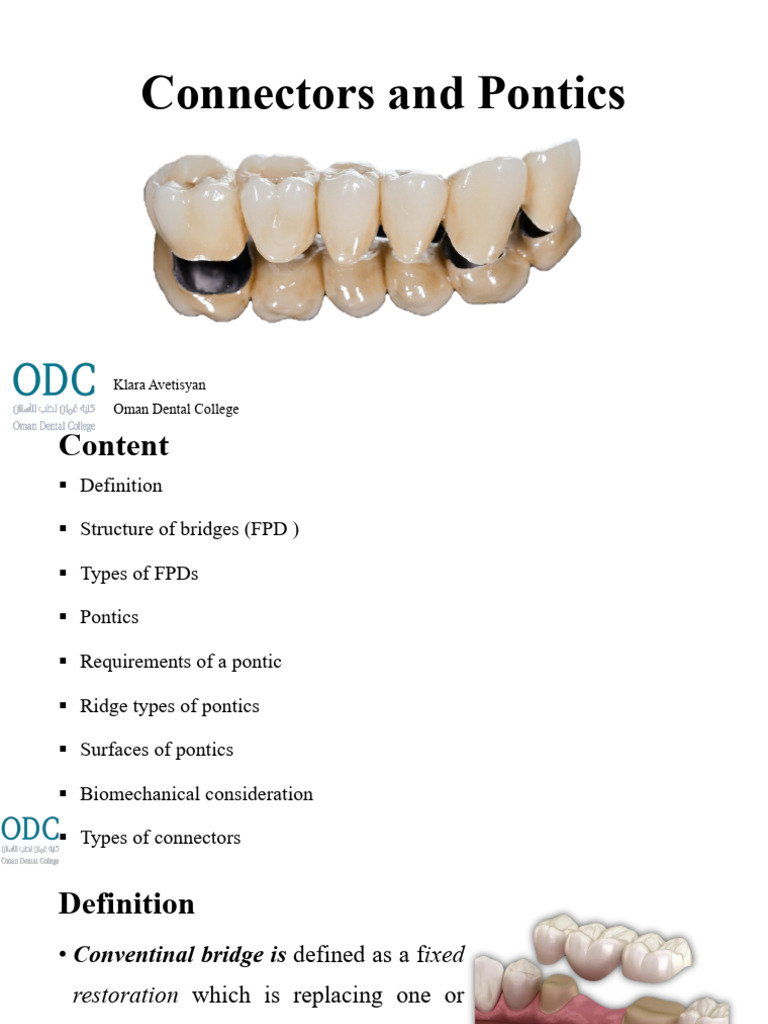 Fixed Partial Dentures: Connectors & Pontics | PDF | Dentistry Branches ...