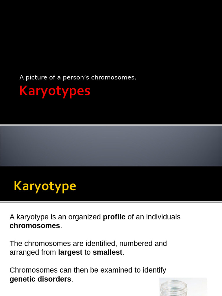 Human Karyotypes 2025 | PDF | Karyotype | Down Syndrome