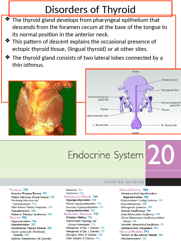 Thyroid Disorders: Types and Effects | PDF | Thyroid | Hypothyroidism