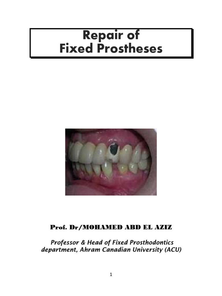 Repair Techniques for Fixed Prostheses | PDF | Materials | Dentistry ...