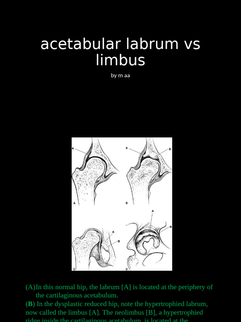 Acetabular Labrum vs Limbus Explained | PDF