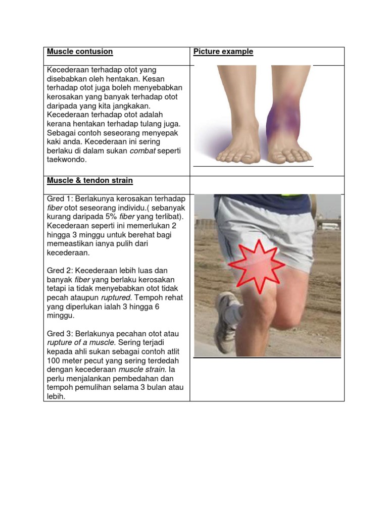 Muscle Contusion | PDF