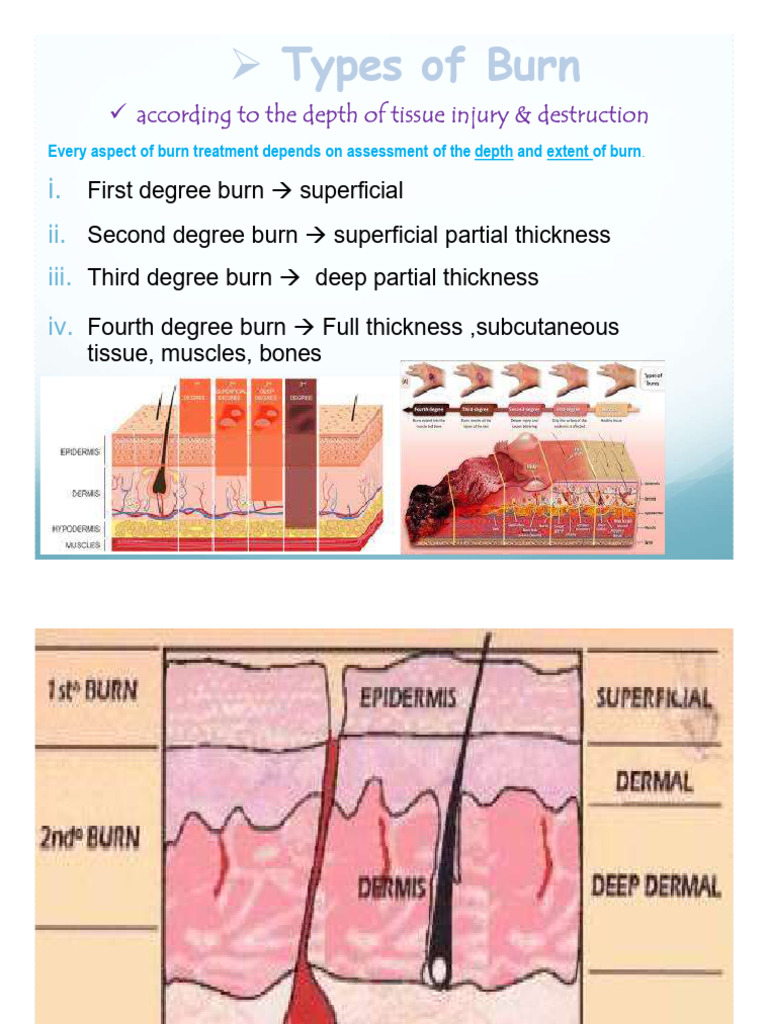 Burn Care by Najim Description Part2-3 | PDF | Burn | Skin