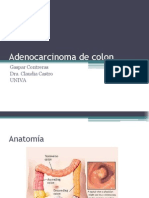 Adenocarcinoma de Colon
