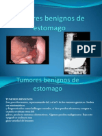 Tumores Benignos de Estomago, Ender