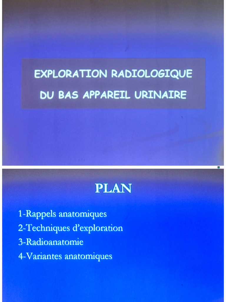 Exploration Radiologique Du Bas Appareil Urinaire | PDF