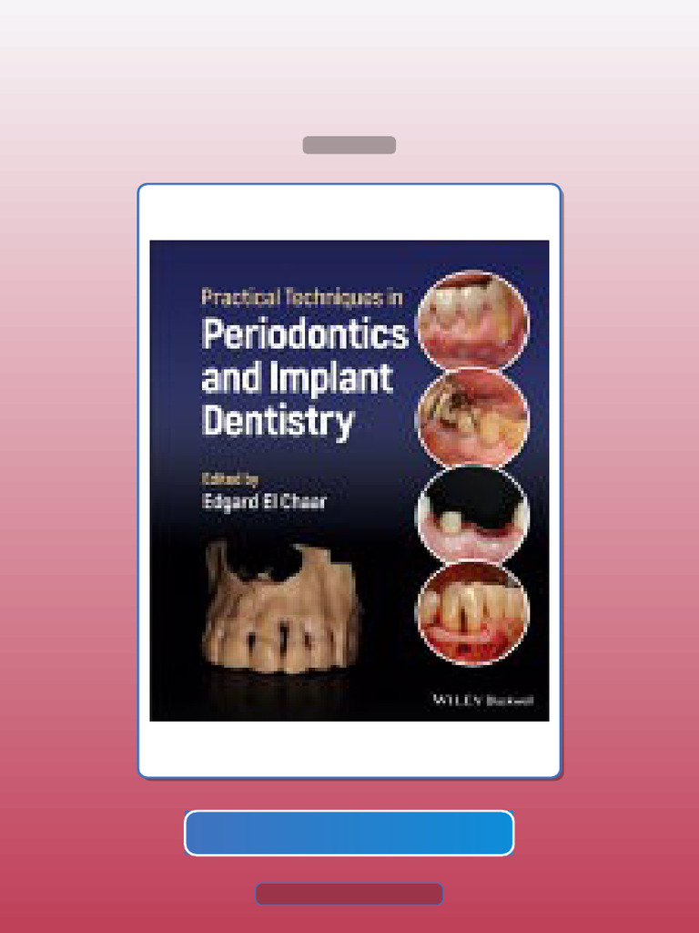 Test Bank for Practical Techniques in Periodontics and Implant ...