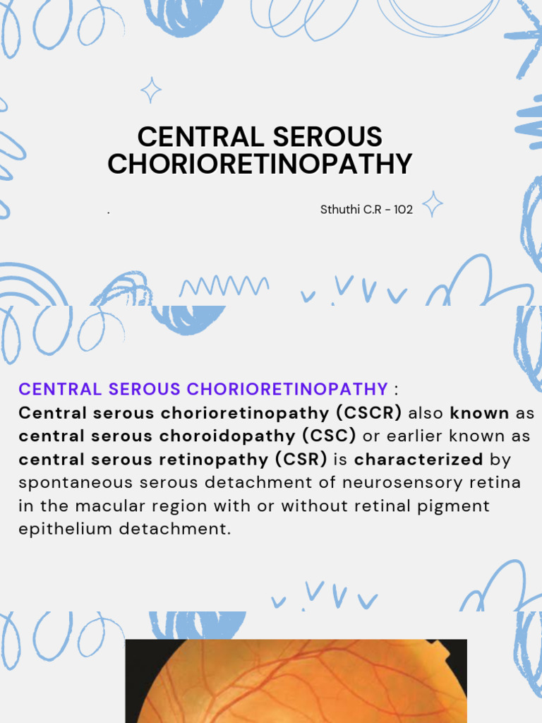 Central Serous Chorioretinopathy Guide | PDF | Vision | Human Eye