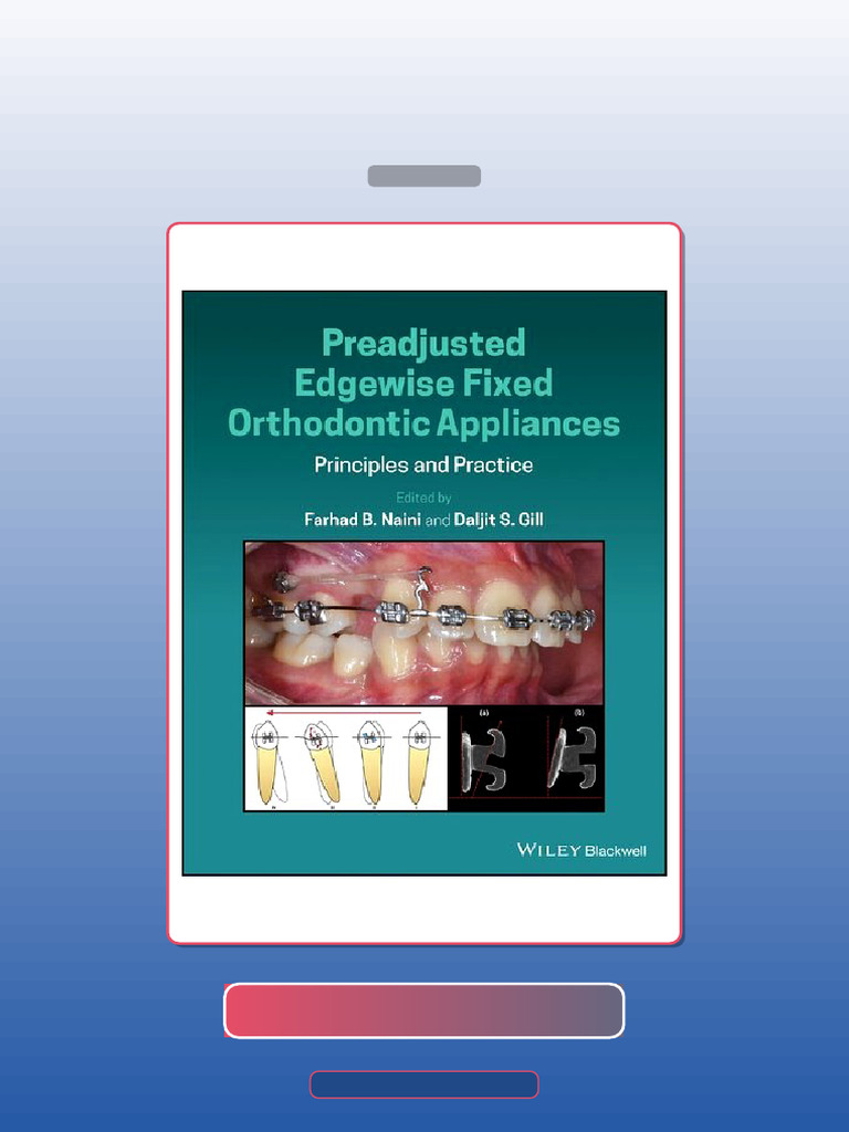 Test Bank for Preadjusted Edgewise Fixed Orthodontic Appliances ...