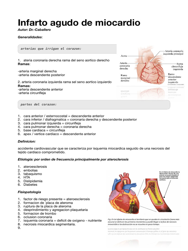 Infarto Agudo de Miocardio: Causas y Tratamiento | PDF | Isquemia ...