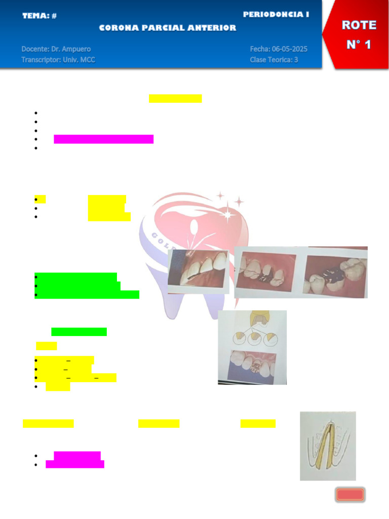 Coronas Parciales Anteriores: Tipos y Usos | PDF | Diente | Anatomia dental