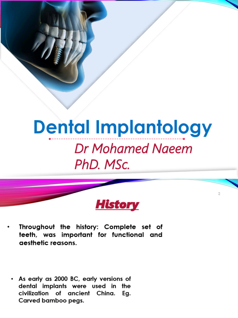 History and Benefits of Dental Implants | PDF | Dental Implant | Dentistry