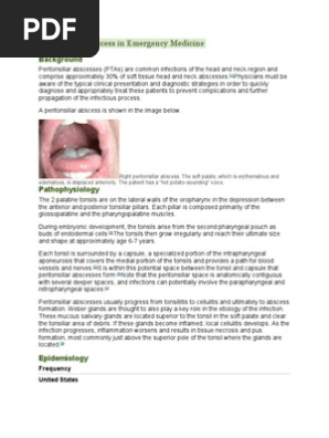 Peritonsillar Abscess In Emergency Medicine Health Sciences