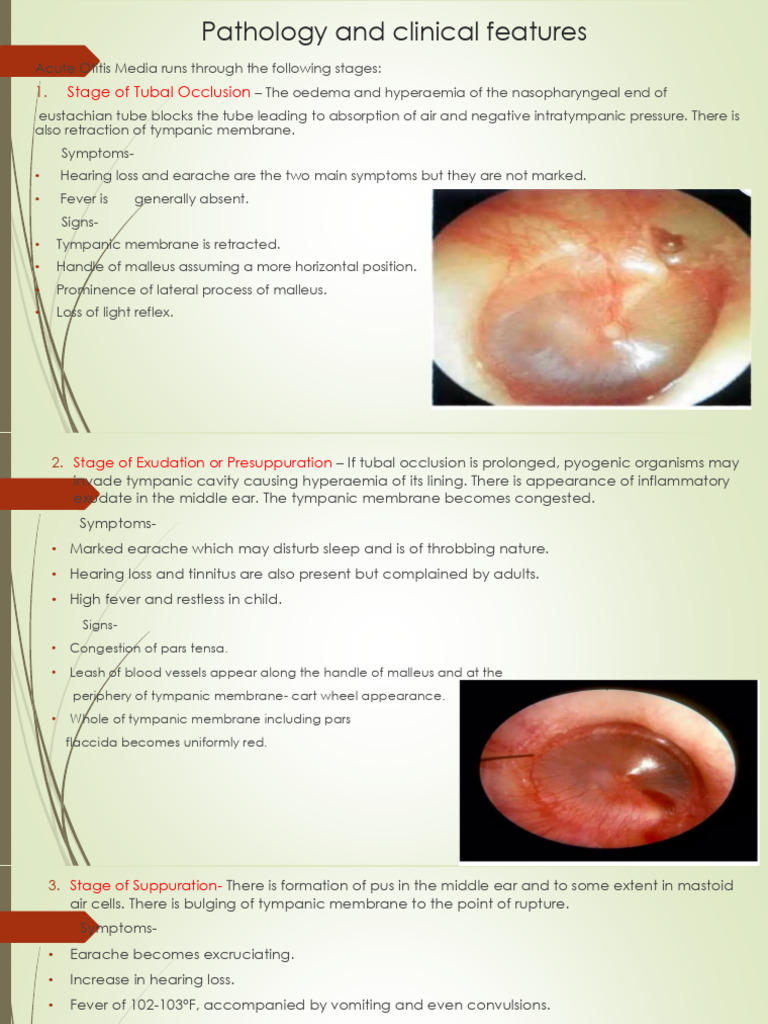 Pathology and Clinical Features Ear | PDF | Ear | Otorhinolaryngology