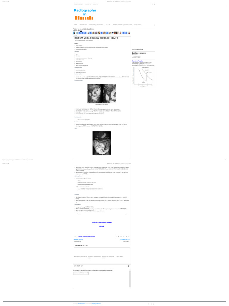 Barium Meal Follow Through _ Bmft - Radiography in Hindi | PDF