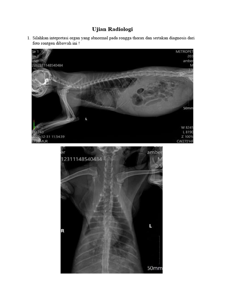 Interpretasi Rontgen Thorax Abnormal | PDF