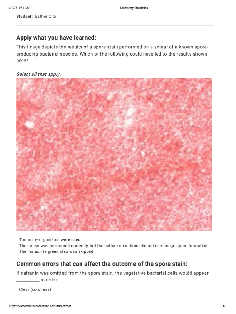 Spore Staining Errors in Bacteria | PDF