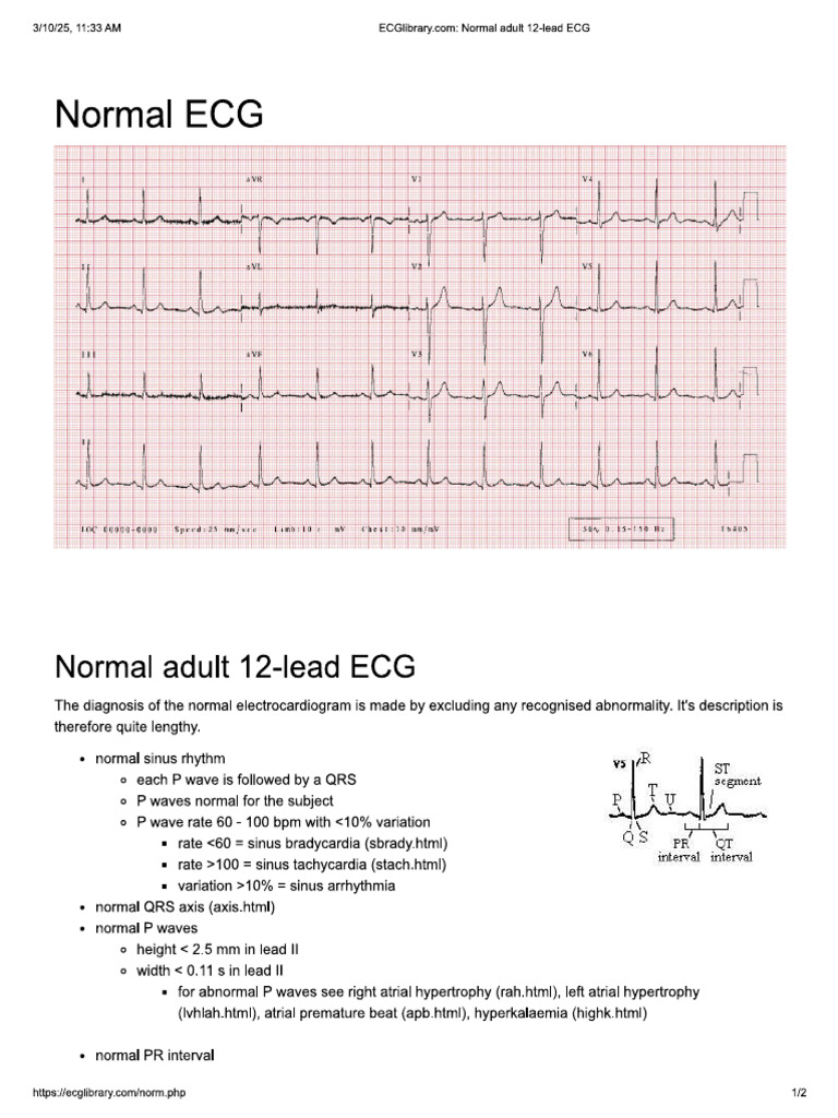 Ecg | PDF