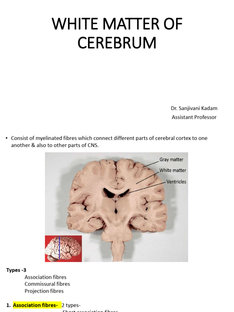 Understanding Cerebral White Matter Types | PDF